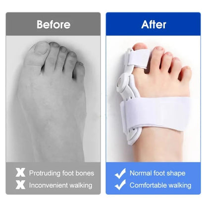 PainShift Toe Brace